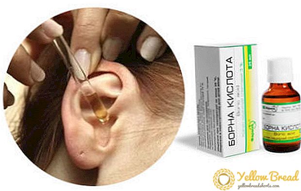 簡単な治療法：ホウ酸を耳に滴下することは可能ですか？禁忌および治療期間
