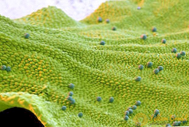 Video: Pod mikroskopom - kolonizirajuća biljka